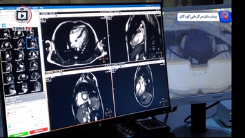 پایان ارجاع بیماران قلبی کودک، ام‌آر‌آی قلب در مرکز طبی کودکان راه‌اندازی شد